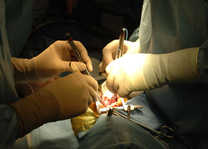 Cardiac Institute Performs Heart Surgery