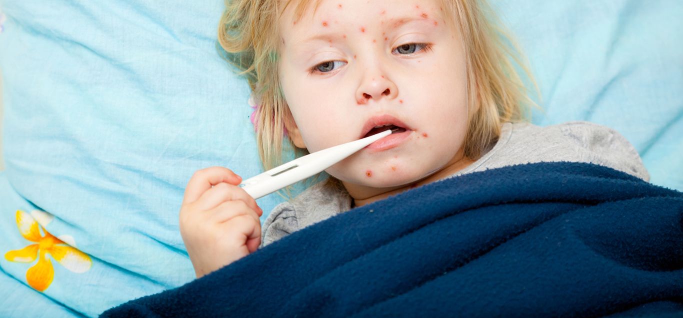 Chickenpox vaccine explained