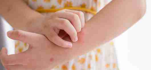 Bumps and Rashes: Common Skin Conditions Explained - Le Bonheur ...