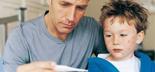Chickenpox 101: Symptoms, Risks and Prevention