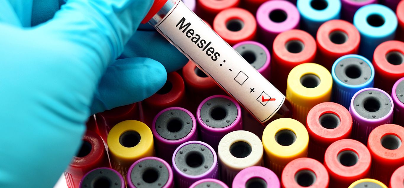 Measles in Tennessee: Why we’re seeing more cases across the country