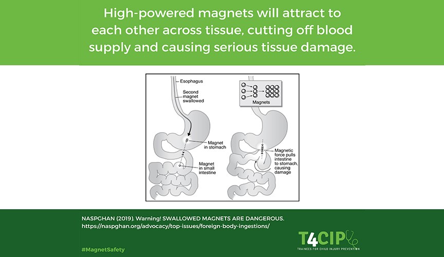 High-powered magnet safety every parent needs to know - Le Bonheur  Children's Hospital