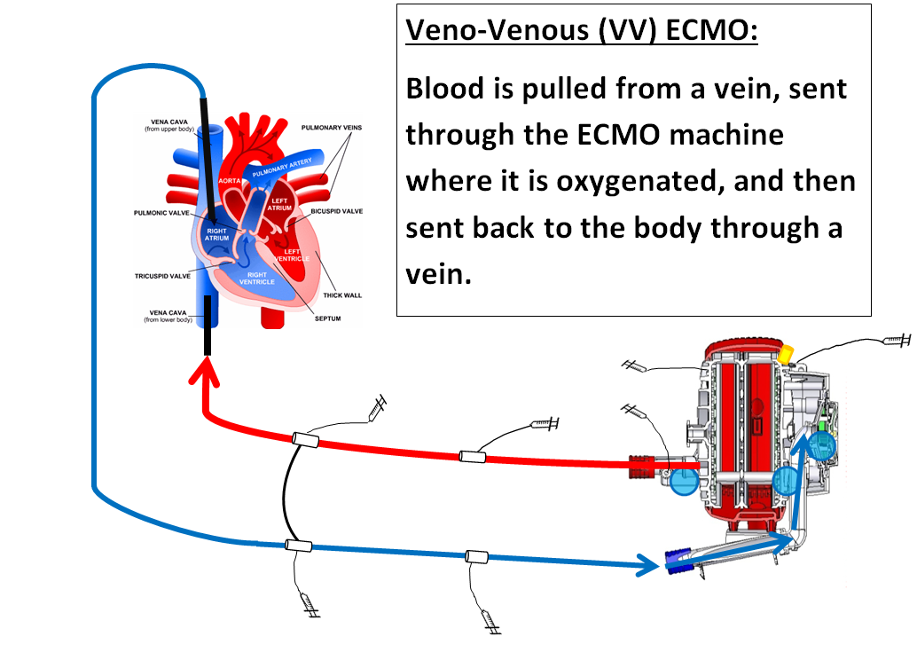 25 Heart Lung Machine Diagram